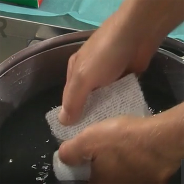 ВИДЕОКУРС: ТЕХНИКА НАЛОЖЕНИЯ ГИПСОВОГО БИНТА ЦЕЛЛОНА image