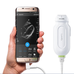 СИСТЕМА УЛЬТРАЗВУКОВАЯ ПОРТАТИВНАЯ LUMIFY image