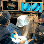 РЕНТГЕНОВСКАЯ С-ДУГА ДЛЯ КОНЕЧНОСТЕЙ OEC ELITE MINIVIEW image