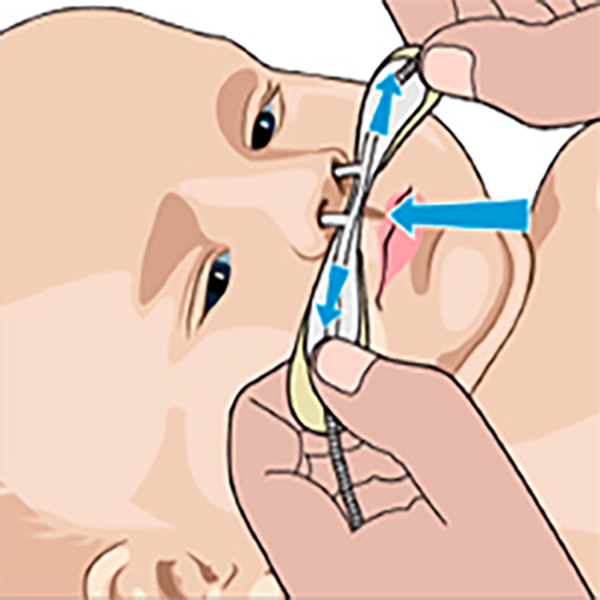 КАНЮЛИ OPTIFLOW ДЕТСКИЕ И НЕОНАТАЛЬНЫЕ image