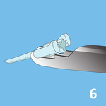 КАРТРИДЖИ ДЛЯ ВВЕДЕНИЯ ЛИНЗ image