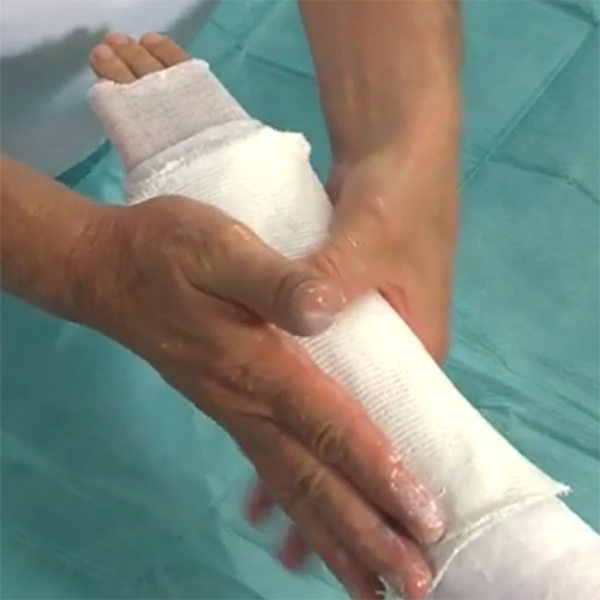 ЛОНГЕТА ИЗ ЦЕЛЛОНЫ НА ПРЕДПЛЕЧЬЕ image