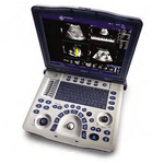 ПОРТАТИВНЫЙ УЗИ АППАРАТ LOGIQ V2 (СРЕДНЕГО КЛАССА) image