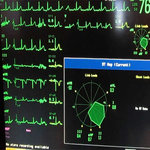 КАРТА СЕГМЕНТА ST image