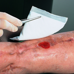 ФЛИВАЦЕЛЬ СИЛЬНОВПИТЫВАЮЩАЯ ПОВЯЗКА (VLIWAZELL) image