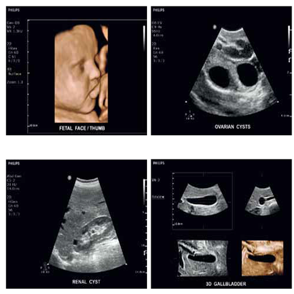 УЛЬТРАЗВУКОВОЙ АППАРАТ CLEARVUE 650 image