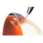 СКАЛЬПЕЛИ С ФИКСИРОВАННОЙ ГЛУБИНОЙ РАЗРЕЗА image