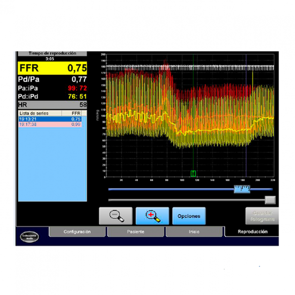 VOLCANO РЕЖИМ FFR ПРОВОДНИКИ VERRATA image