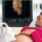 УЛЬТРАЗВУКОВОЙ АППАРАТ CLEARVUE 650 image