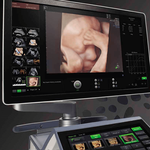 ЗНАМЕНИТЫЙ УЗИ АППАРАТ VOLUSON E8 (ЖЕНСКОЕ ЗДОРОВЬЕ) image