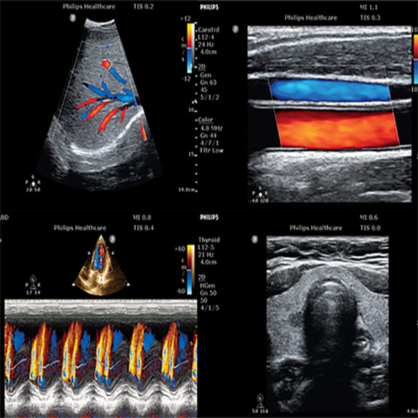 УЛЬТРАЗВУКОВОЙ АППАРАТ CLEARVUE 850 image