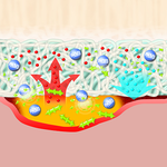 СУПРАСОРБ X+PHMB (SUPRASORB X+PHMB) ГИДРОБАЛАНС С АНТИБАКТЕРИАЛЬНЫМ ЭФФЕКТОМ image