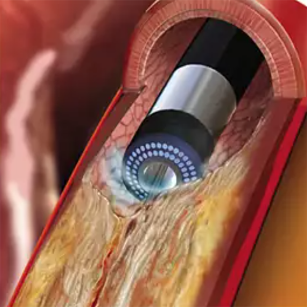ЭКСИМЕРНАЯ ЛАЗЕРНАЯ СИСТЕМА CVX-300 EXCIMER image