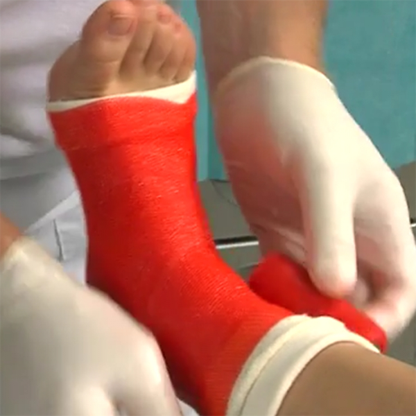 ЛОНГЕТА ИЗ ЦЕЛЛАКАСТА НА ГОЛЕНОСТОП image