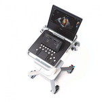 УЛЬТРАЗВУКОВОЙ ПОРТАТИВНЫЙ АППАРАТ ЭКСПЕРТНОГО КЛАССА PHILIPS 5500 image