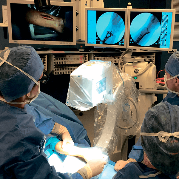 РЕНТГЕНОВСКАЯ С-ДУГА ДЛЯ КОНЕЧНОСТЕЙ OEC ELITE MINIVIEW image