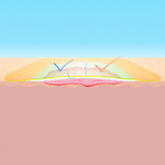 СУПРАСОРБ P (SUPRASORB P) ПОЛИУРЕТАНОВАЯ ГУБКА image