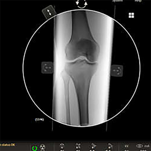 VERADIUS UNITY ПЕРЕДВИЖНОЙ РЕНТГЕНХИРУРГИЧЕСКИЙ АППАРАТ С ПЛОСКИМ ДЕТЕКТОРОМ image