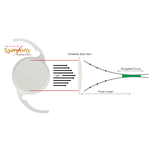 ЛИНЗА С ПРОЛОНГИРОВАННЫМ ФОКУСОМ ИНТРАОКУЛЯРНАЯ (IOL) TECNIS SYMFONY image