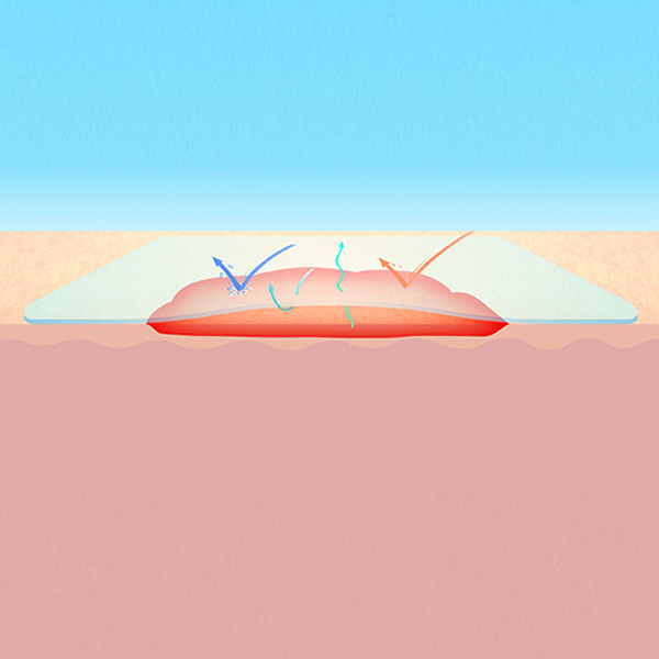 СУПРАСОРБ F (SUPRASORB F) ПЛЕНКА ЗАЩИТНАЯ image