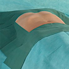 ОПЕРАЦИОННОЕ БЕЛЬЕ ДЛЯ ЛАПАРОСКОПИИ