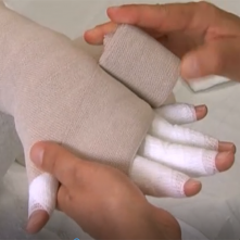 ВИДЕОКУРСЫ ПО БИНТОВАНИЮ ПРИ ЛЕЧЕНИИ ЛИМФАТИЧЕСКИХ ОТЕКОВ