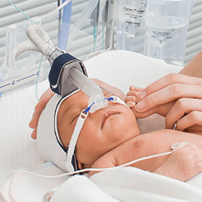 СИПАП (CPAP) ТЕРАПИЯ НОВОРОЖДЕННЫХ