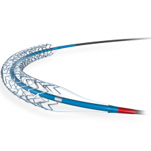 КОРОНАРНЫЕ СТЕНТЫ