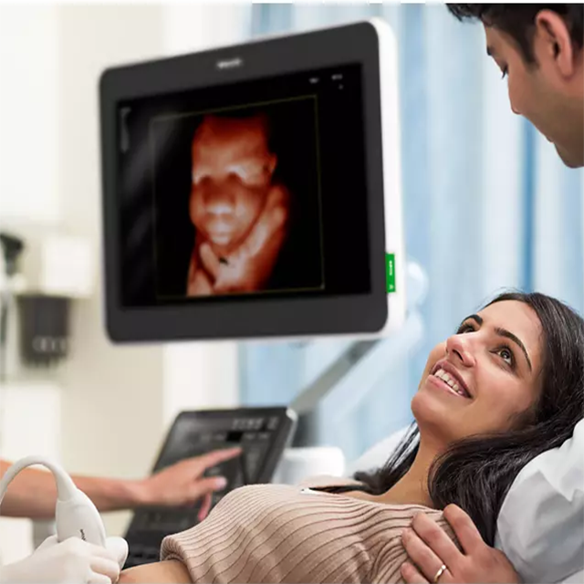 Изображение УЛЬТРАЗВУКОВАЯ СИСТЕМА ПРЕМИУМ КЛАССА PHILIPS EPIQ ELITE