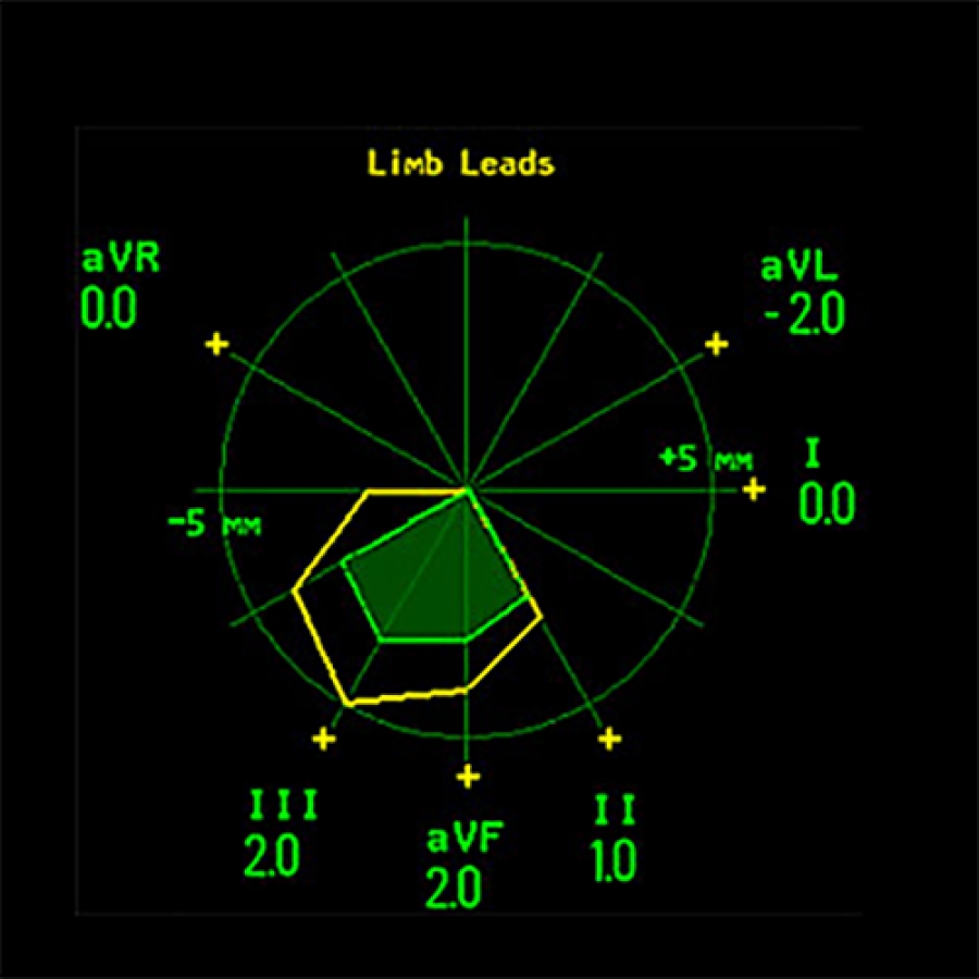 КАРТА СЕГМЕНТА ST